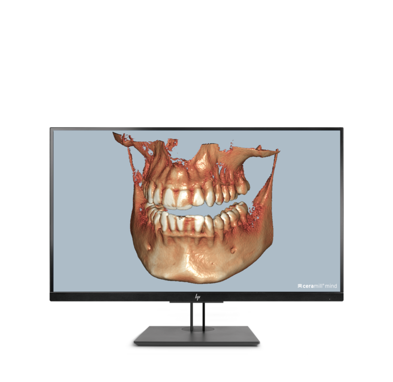 Ceramill Dicom-Viewer