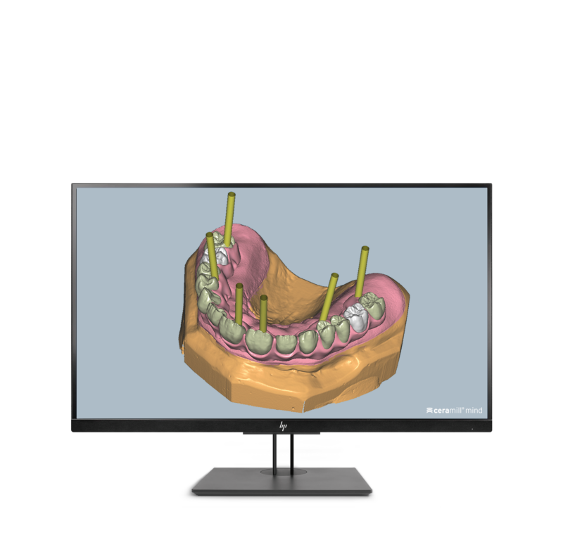 Ceramill M-Gin