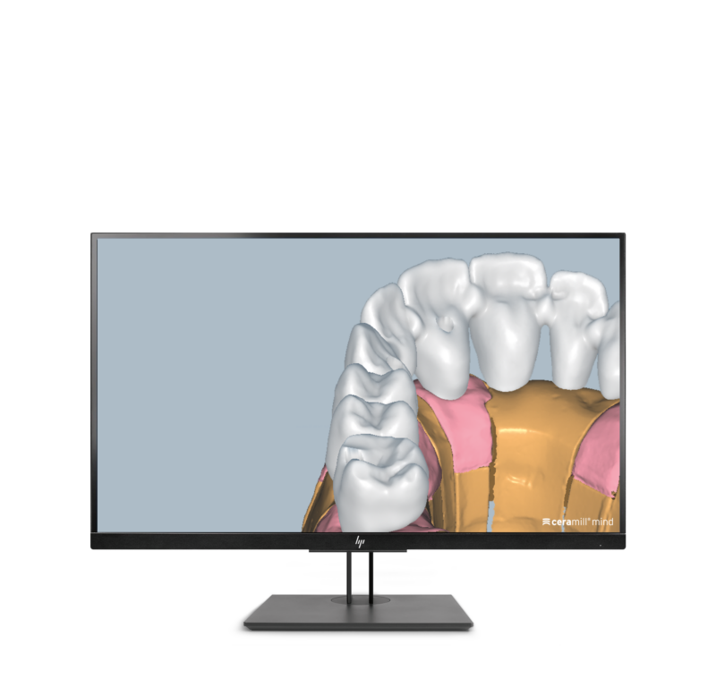 Ceramill M-Plant