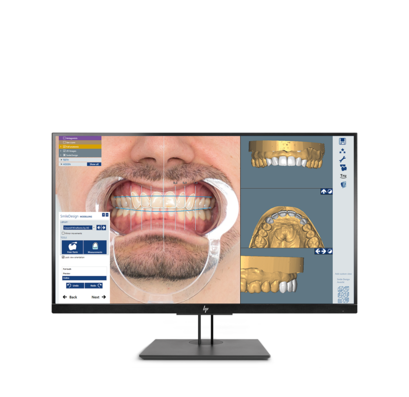 Ceramill M-Smile