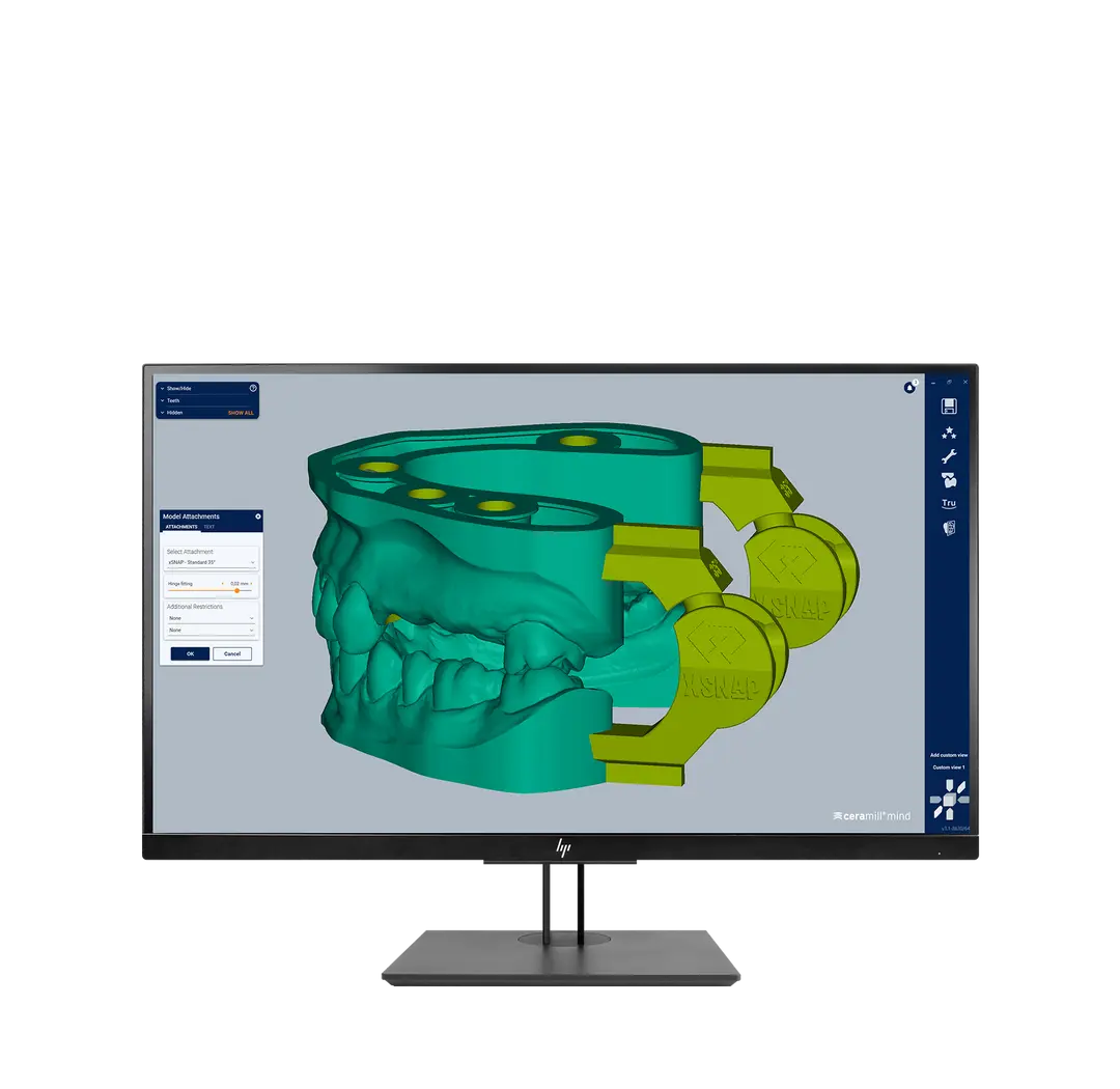 xSNAP for Ceramill