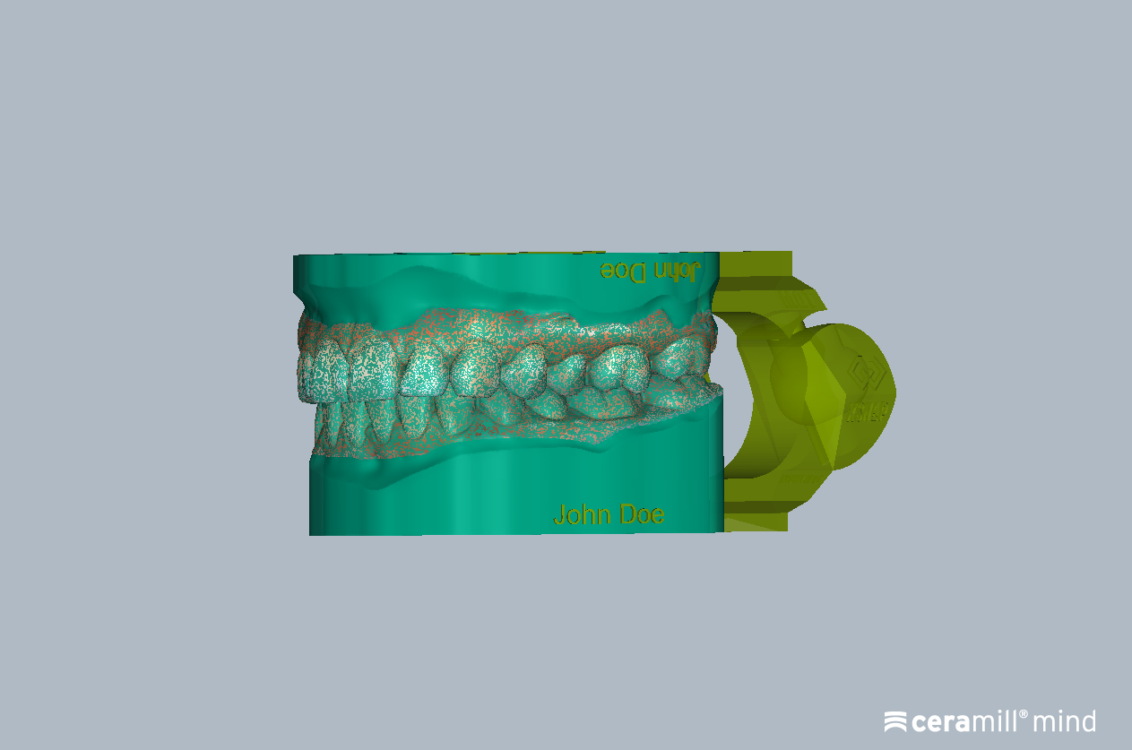 Ceramill Mind: Ceramill M-Build